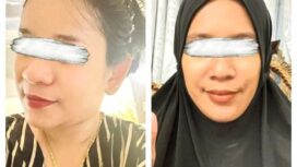 Seorang perempuan bernama Meity Jayasari alias Suri diduga melakukan serangkaian penipuan dan penggelapan dana dengan nilai kerugian mencapai miliaran rupiah